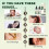 2PCS Ear Care Drops Gentle Formula, Non-Irritating Gentle Formula, Tinnitus 2