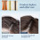 3pcs Double Sided Lice and Dandruff Comb Set with DualSided Teeth Ergonomic Grip MultiColor 2