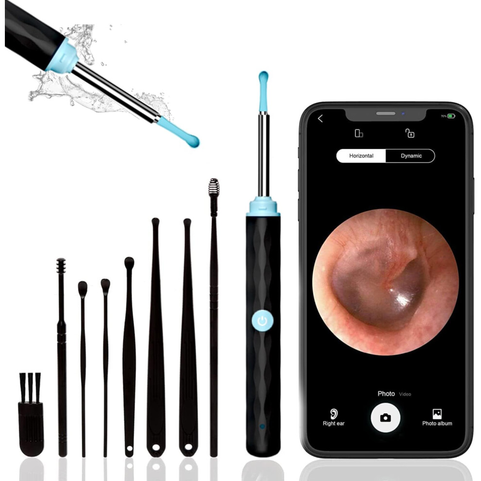 Ear Wax Removal Camera 1296P FHD LED Light Wireless Ear Cleaning Kit for iPhone Android White