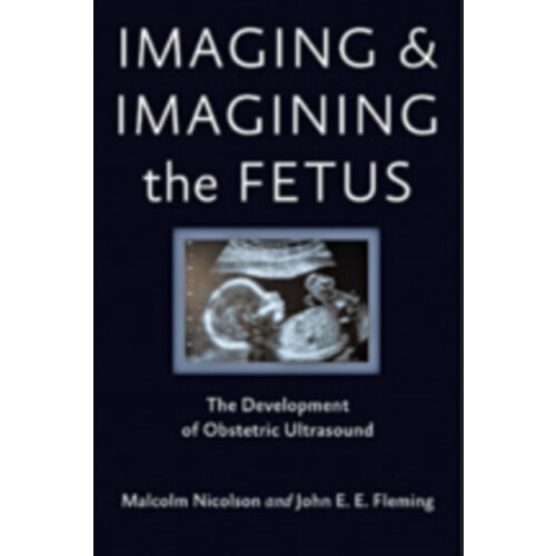 Imaging and Imagining the Fetus by John E. E. Fleming Hardcover Book