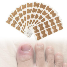 Ingrown Toenail Corrector Patch 100pcs Pain Relief Breathable NonWoven Strips 0.5'x0.7'