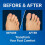 2PCS Gel Toe Separators Bunion Corrector for Overlapping Toes Women Men Clear Toe Alignment Support 2