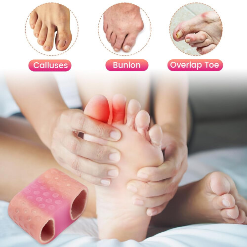 Toe Separators for Women 2PC Silicone Dual Loop Bunion Corrector for Comfortable Toe Alignment 2