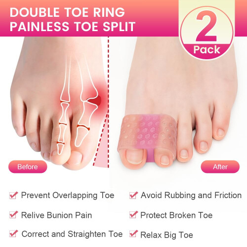 Toe Separators for Women 2PC Silicone Dual Loop Bunion Corrector for Comfortable Toe Alignment 1