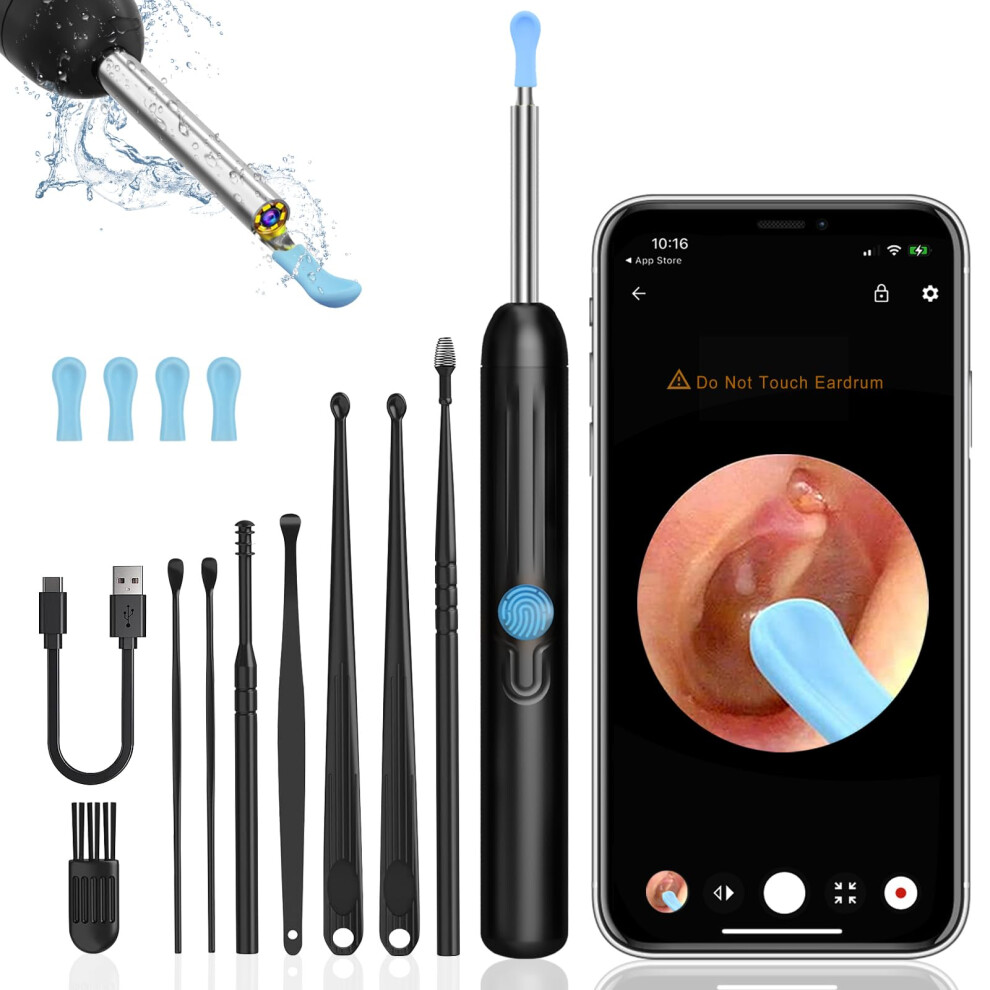 Ear Wax Removal Kit with 1296P HD Camera, LED Lights, WiFi, iOS and Android Compatible