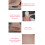 Mastectomy Prosthetic Chest C Cup Color 1 5