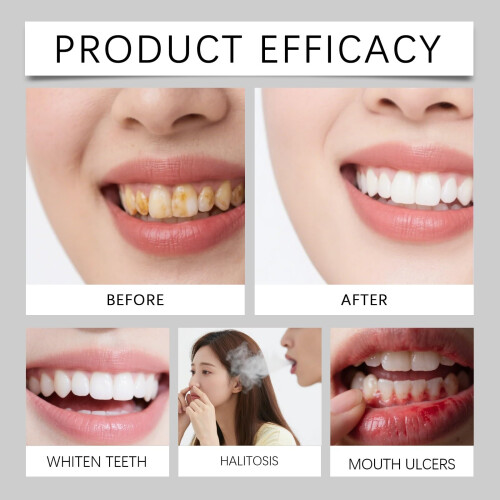 Teeth Whitening Toothpaste, Gentle Purple Formula for Bright Smile, Low Sensitivity, 2 Pack 2