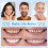 Natural Looking Dentures Set for Adults, Removable False Teeth with Quick Custom Fit Upper and Lower 3