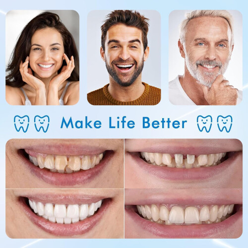 Natural Looking Dentures Set for Adults, Removable False Teeth with Quick Custom Fit Upper and Lower 2