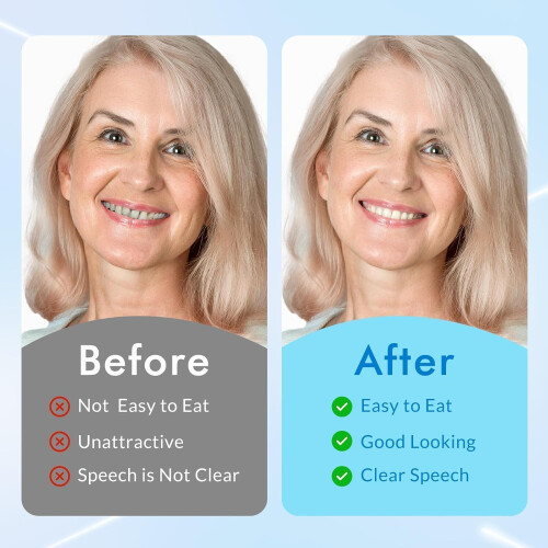 Natural Looking Dentures Set for Adults, Removable False Teeth with Quick Custom Fit Upper and Lower 1