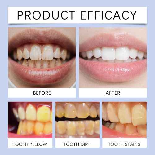 Mint Toothpaste for Stain Removal and Teeth Whitening, Deep Cleaning Action, 3pcs 1