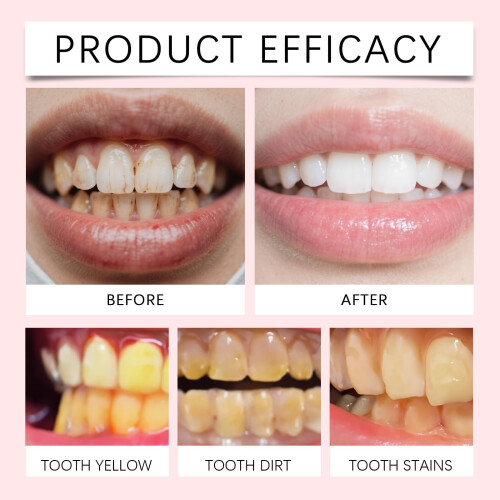 Toothpaste for Sensitive Teeth Enamel  with Deep Cleaning and Long Lasting Fresh Breath 1pcs 2