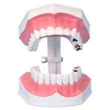 Dental Teaching Model 2X Enlarged with Removable Teeth and Tongue for Kids Tooth Brushing Training