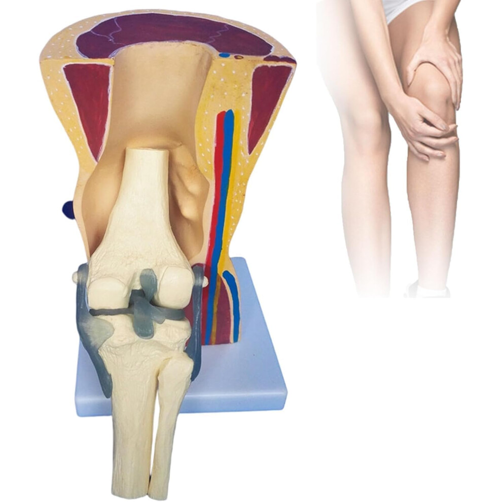 Anatomical Knee Joint Model with Ligaments, LifeSize PVC with Detachable Parts for Medical Teaching