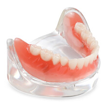 Dental Implant Overdenture Teaching Model with Transparent Acrylic Base and Removable Lower Denture