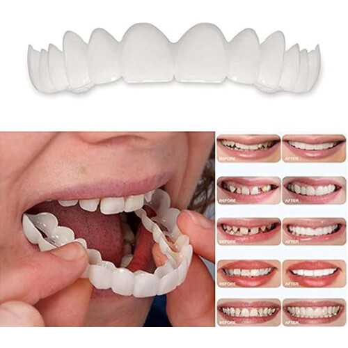 Fake Teeth Temporary Veneers for Missing Teeth, Adjustable Secure Fit,  and Bottom Set, 2 Pairs 1