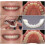 Fake Teeth Temporary Veneers for Missing Teeth, Adjustable Secure Fit,  and Bottom Set, 2 Pairs 5