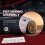 Kit di Montaggio Fasce Elastiche per  120i 320i E82 E83 E85 E87 E88 E46 E90 E91 E92 E93 11257541469 11257556435 3