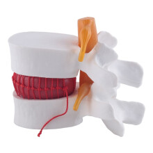 Human Anatomy Skeleton Spine Lumbar Disc Herniation Teaching Model Brain Skull Traumatic School Supplies Instrume