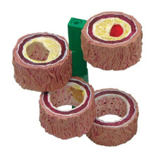 Modelo de Arteria del Cuerpo Humano de 4 Piezas, Modelo de Réplica Anatómica, Modelo de Esclerosis y Trombo, Modelo de Vaso Sanguíneo