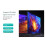 Weergavemodule -Compatibele Splittermodule 1 in 2 Settopbox PS Host Notebook 1 in 2 Uit Monitormodule 9