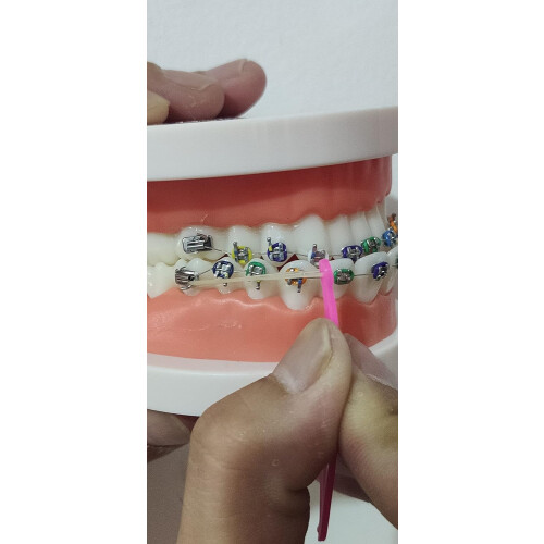Orthodontic Elastic Placers for Braces Rubber Bands Tool 15 Pcs MultiColor DualEnd Hook Pusher 2
