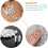 Plastic Shutter Pin 40Pcs Shutter Repair Pin Set Spring Loaded Repair Pin Replacement Shutter Pin Tools Louvers 6
