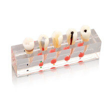 Dental Teaching Model with Detailed Tooth Anatomy for Endodontic Training and Patient Education
