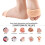 Metatarsaldynor Beige 3 par bolldynor 3