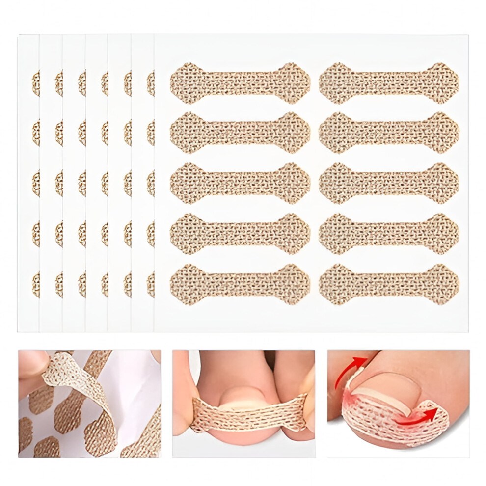 Ingrown Toenail Treatment Kit with Strips and Pedicure Tool