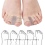 2PCS Overlapping Toe Separators for Correcting Toe Alignment 5