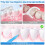 160 Pcs Interdental Brushes for Braces, 4 Sizes, Soft & Bendable – Compatible with Braces 5