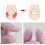 Patchs correcteurs d'ongles incarnés IRQI, lot de 10 4