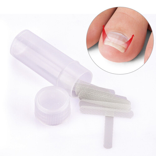 Patchs correcteurs d'ongles incarnés IRQI, lot de 10 1
