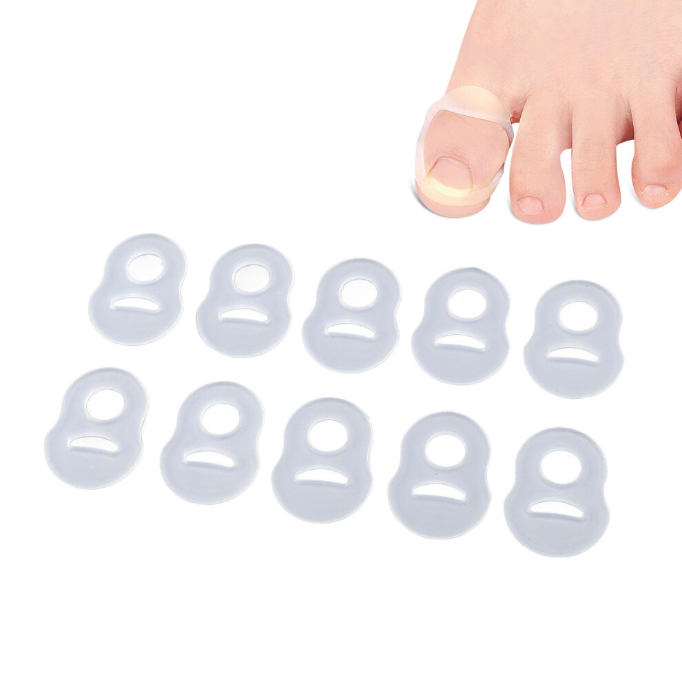 10 Pcs Silicone Ingrown Toenail Corrector Rings for Pain Relief and Nail Growth Correction
