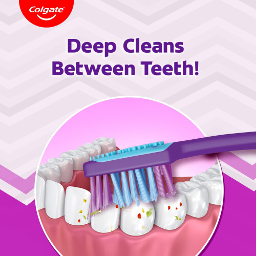 Colgate Colgate Zigzag Toothbrush for Deep Inter Dental Clean with Multi Angle Zig zag bristles (Medium, Pack of 6) 1