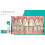Opalescence Opalescence Whitening Toothpaste Sensitivity Relief 100ml 2