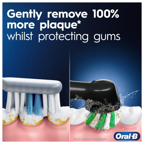 Oral-B Oral-B Pro 1 Electric Toothbrush, Old 1