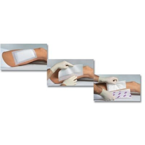 ADHESIVE DRESSING Hypafix 10 CM X 10 M 1