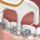 Plackers Orthopick Dental Floss Picks for Braces, 36 Count 6