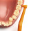 Tepe TePe Angle Orange Interdental Brushes (0.45mm - Size 1) / Easy and simple interspace cleaning with long handle and angled neck / 2 5