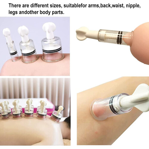 2pcs Adjustable Suction Nipple Sucker Vacuum Cups for Effective Nipple Correction Large Size 2