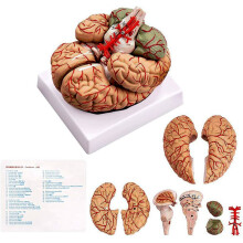Ludzki MóZg, Model Anatomii Ludzkiego MóZgu WielkośCi Naturalnej z Podstawą WyśWietlacza, do Nauki w Klasie i do Nauczania WyśWietlacz A