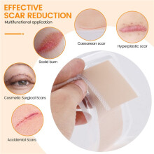 3PC Efficiente Chirurgia Rimozione Della Cicatrice Foglio di Gel di Silicone Terapia Patch per Acne Trauma Bruciare Cicatrice Riparazione Della Pelle