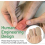 10 Pack Closed Toe Surface Fabric Cover Protectors with Gel Lining - For Large and Medium Sizes 4