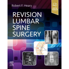 Revision Lumbar Spine Surgery Hardcover Book