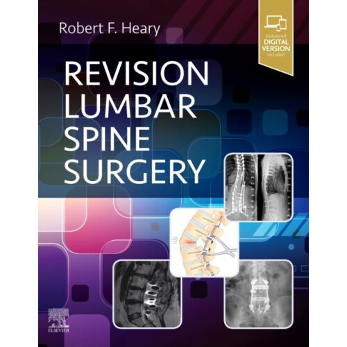 Revision Lumbar Spine Surgery Hardcover Book