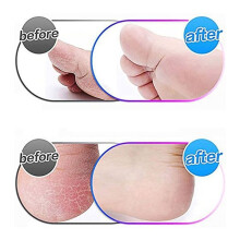 12 Pack Extra Coarse Replacement Roller for Pedi,Replacement Refills Compatible with Pedi Refills