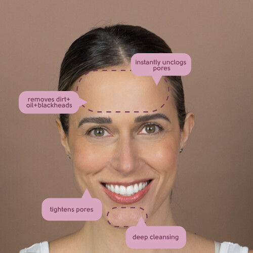 Face Facts Witch Hazel Forehead & Chin Pore Strips 2