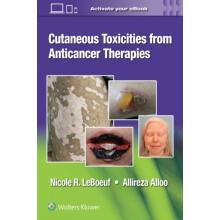 Cutaneous Toxicities from Anticancer Therapies by Nicole LeBoeuf Paper